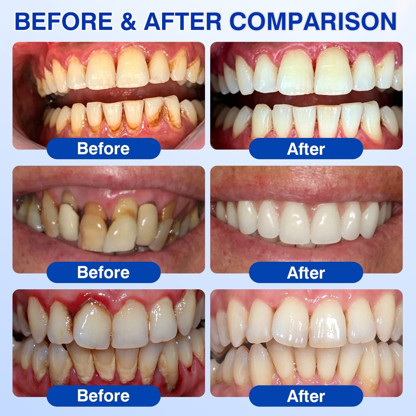 🇦🇺👨‍⚕️✅️💉Evolvion® GumRevive Periodontal Repair Gel