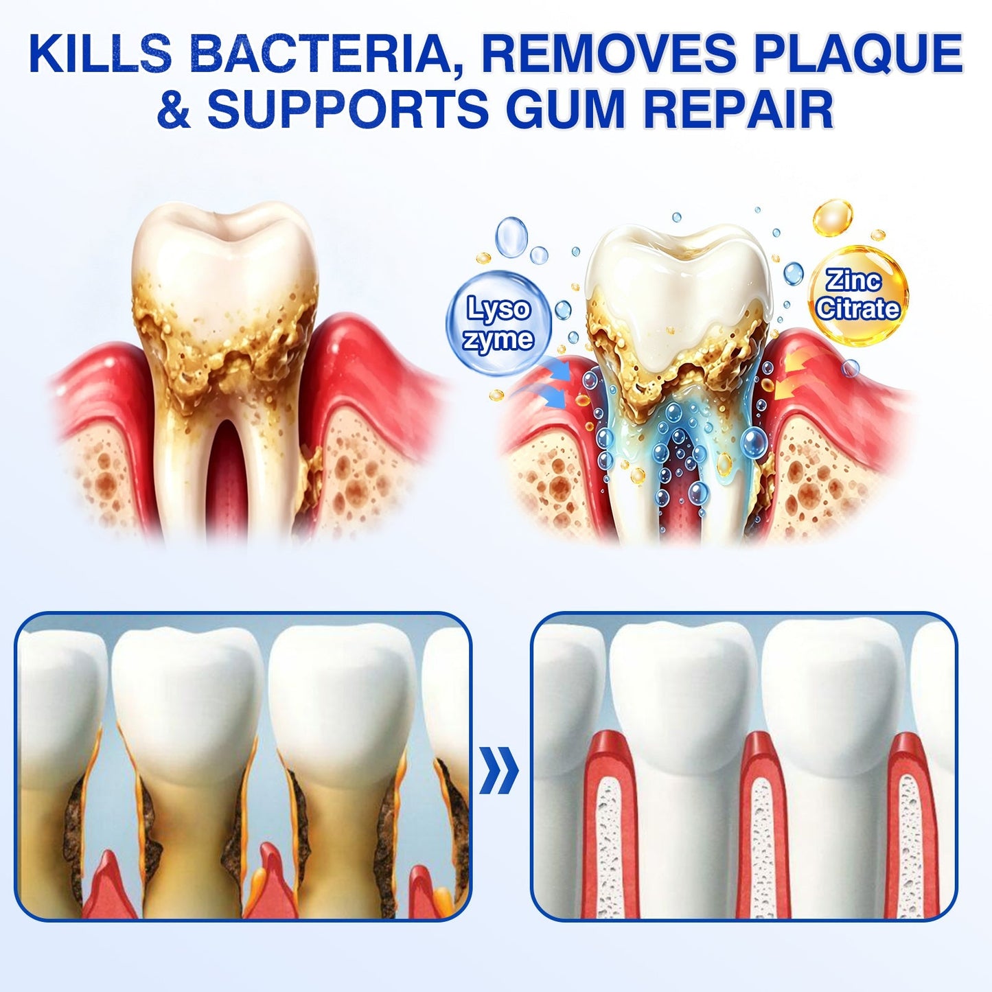 🇦🇺👨‍⚕️✅️💉Evolvion® GumRevive Periodontal Repair Gel