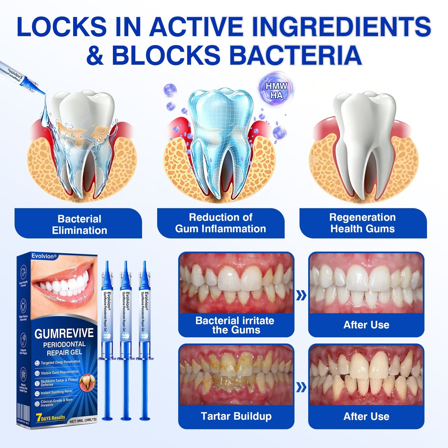 🇦🇺👨‍⚕️✅️💉Evolvion® GumRevive Periodontal Repair Gel