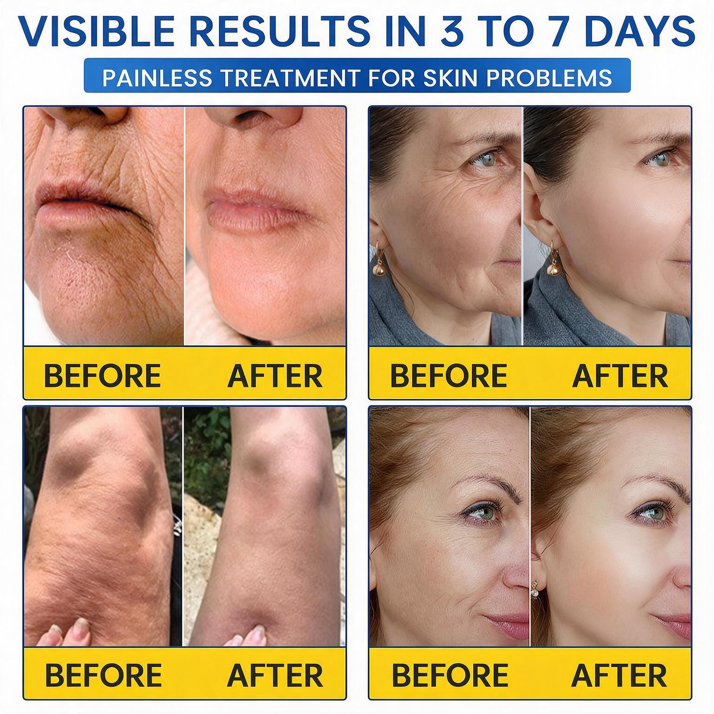 💠🔹🔷U HOT SALE Natravor® PDRN Anti-Wrinkle Shot – Lift & Firming Cream