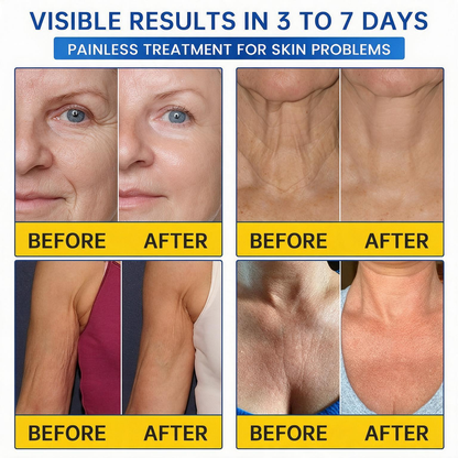 💠🔹🔷U HOT SALE Natravor® PDRN Anti-Wrinkle Shot – Lift & Firming Cream