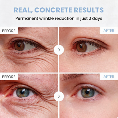 💠🔹🔷U HOT SALE Natravor® PDRN Anti-Wrinkle Shot – Lift & Firming Cream