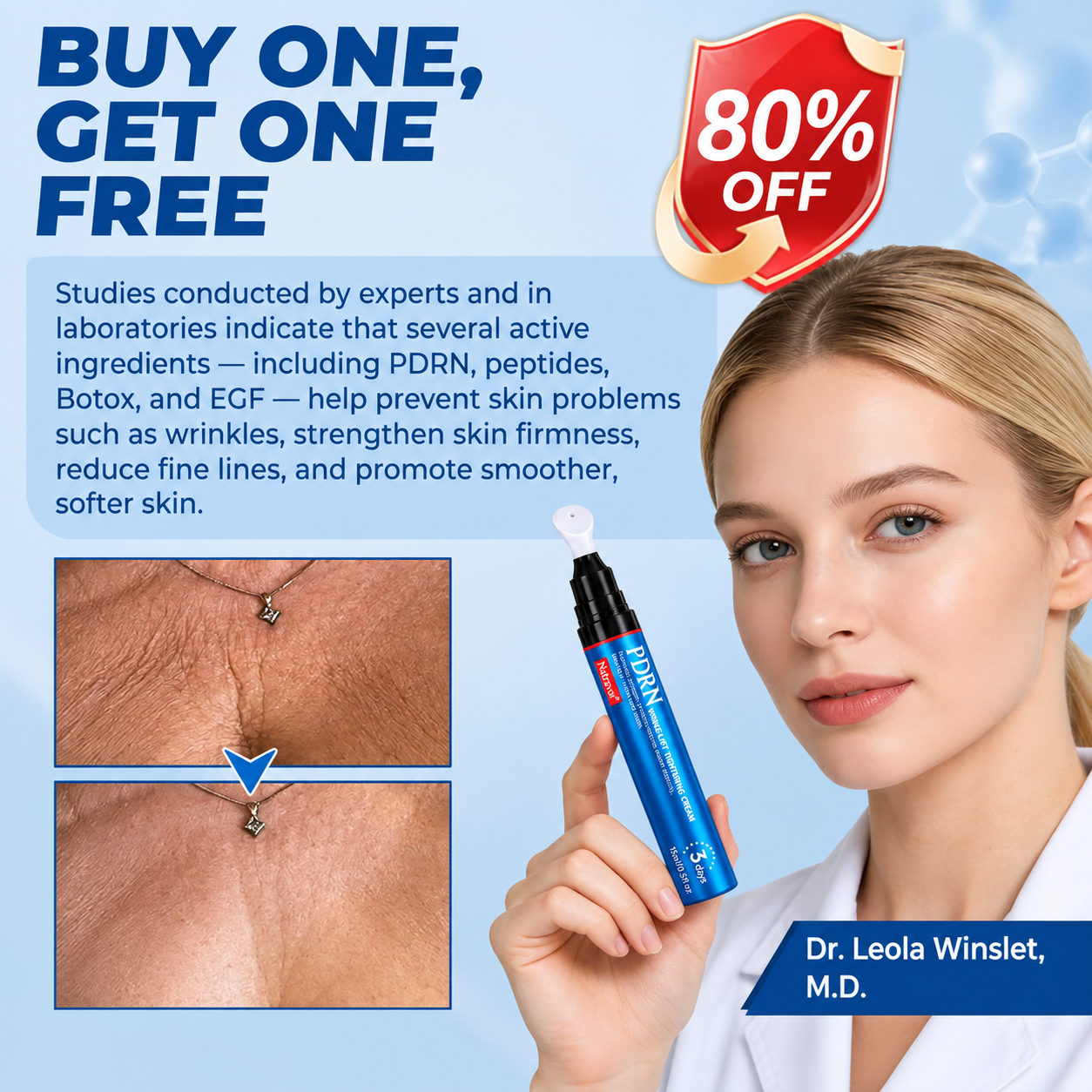 💠🔹🔷U HOT SALE Natravor® PDRN Anti-Wrinkle Shot – Lift & Firming Cream