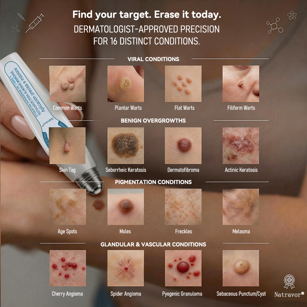 👩‍⚕️Natravor® 7-Day Skin Care Roller Pen 🎆 | Easy At-Home Solution for Skin Imperfections