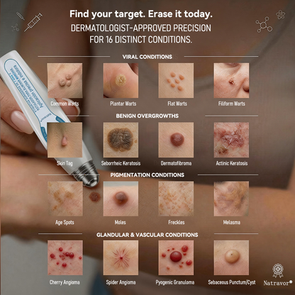 👩‍⚕️Natravor® 7-Day Skin Care Roller Pen 🎆 | Easy At-Home Solution for Skin Imperfections