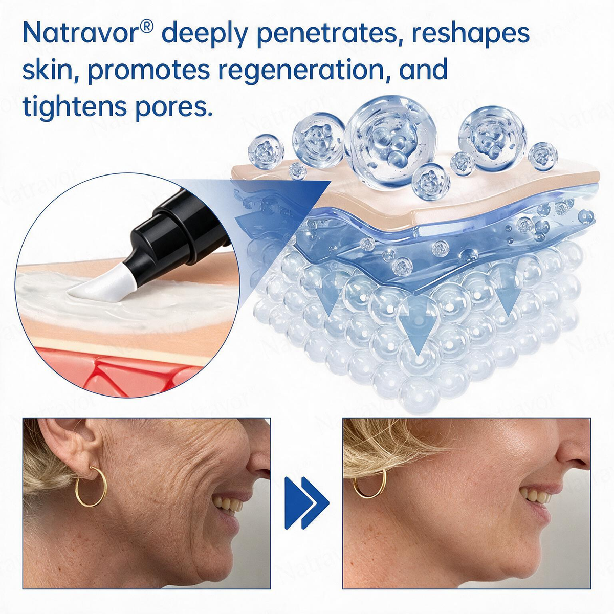 💠🔹🔷U HOT SALE Natravor® PDRN Anti-Wrinkle Shot – Lift & Firming Cream